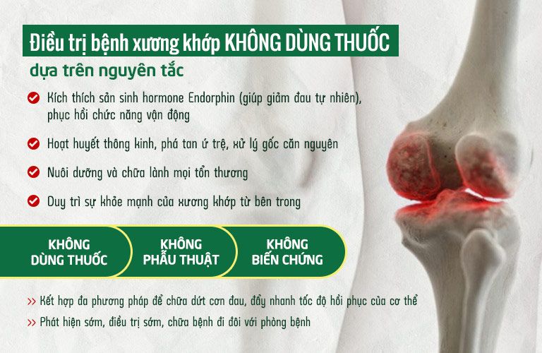 Nguyên tắc điều trị xương khớp không dùng thuốc