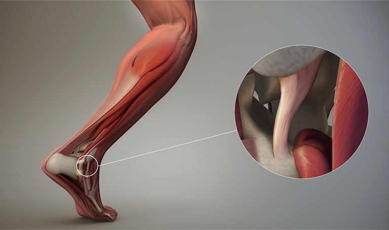 Ligament giúp việc di chuyển trở nên dễ dàng hơn