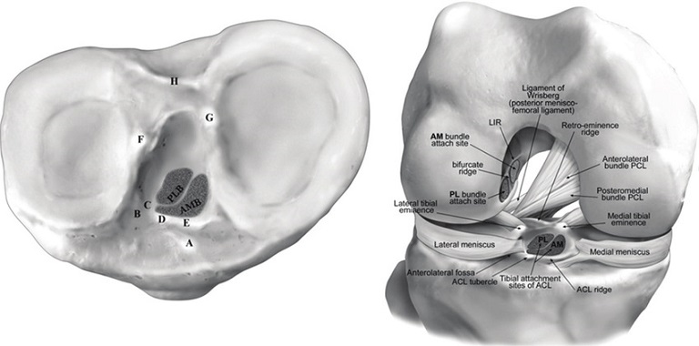 Intercondylar lại được chia thành 2 phần trước và sau