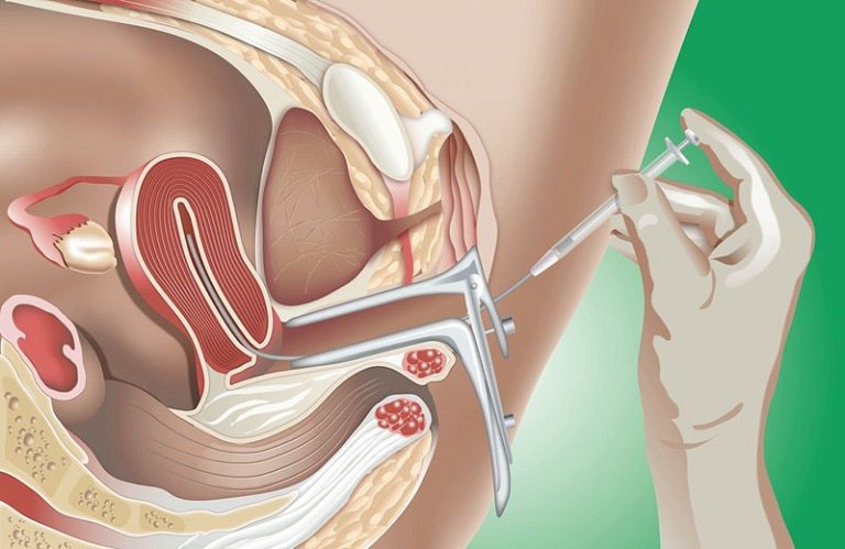 Y học hiện đại đã có nhiều cách để hỗ trợ mang thai hiệu quả