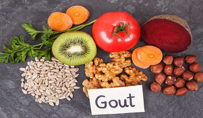 Mắc Bệnh Gout Kiêng Gì Để Kiểm Soát Bệnh Hiệu Quả