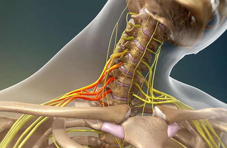Tổn thương mạch máu, dây thần kinh xương quai xanh
