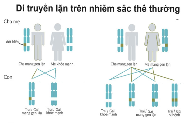 Bệnh di truyền lặn trên nhiễm sắc thể thường (Autosomal Recessive)